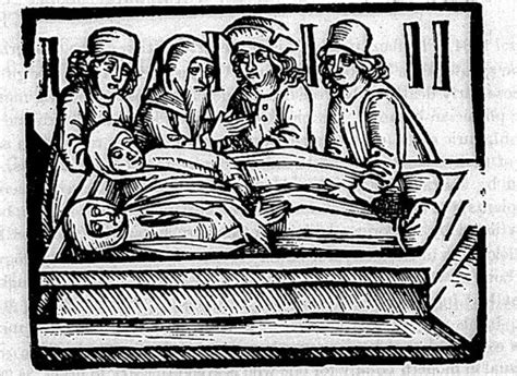 bidone aspora tutt tudor|Sweating Sickness in Tudor England 1485.